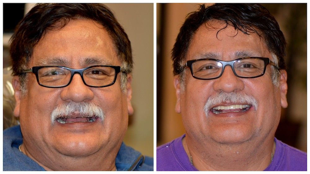 before--after-05-dedicated-dental