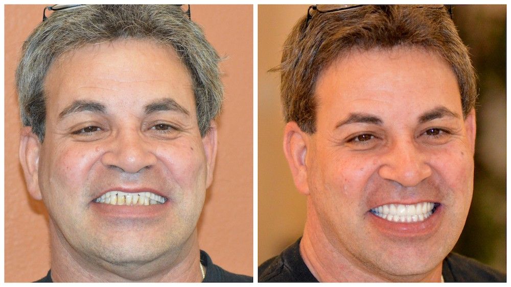 before--after-07-dedicated-dental